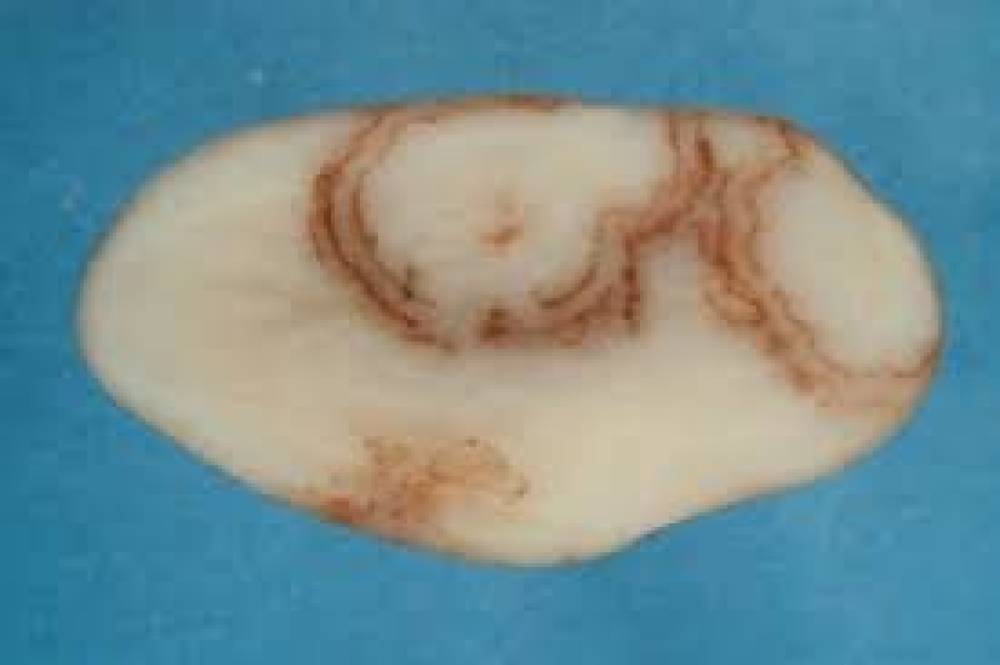 ऑस्ट्रेलिया में पहली बार मिला मॉप-टॉप आलू वायरस, तस्मानिया में सतर्कता