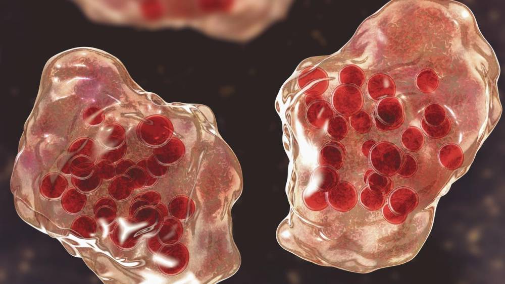 पर्थ और पिलबरा में खसरे के नए मामले सामने आए, FIFO श्रमिकों को सतर्क रहने की सलाह