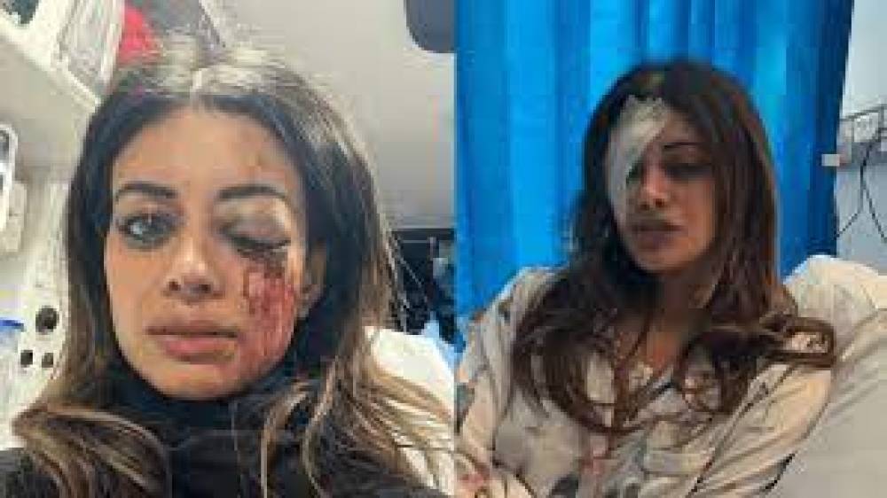 पूर्व ग्रीन उम्मीदवार हन्ना थॉमस पुलिस कार्रवाई को कोर्ट में देंगी चुनौती, गिरफ्तारी के दौरान आंख में गंभीर चोट