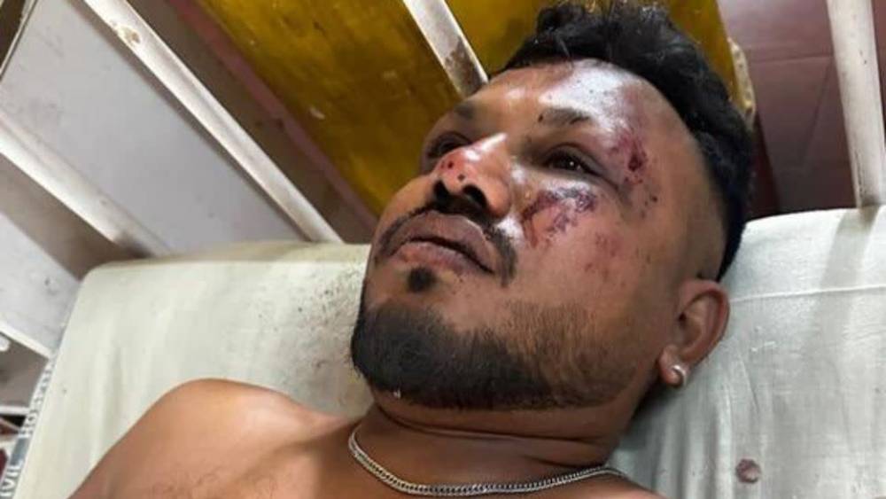 Ahmedabad Plane Crash: Miracle Survivor Speaks from Hospital Bed – “It’s Nothing Short of a Blessing”